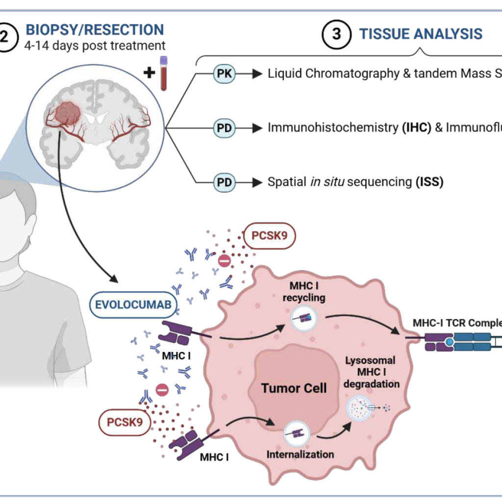 A surgical window of opportunity trial evaluating the effect of the PCSK9 inhibitor evolocumab on tumoral MHC-I expression and CD8+ infiltration in glioma